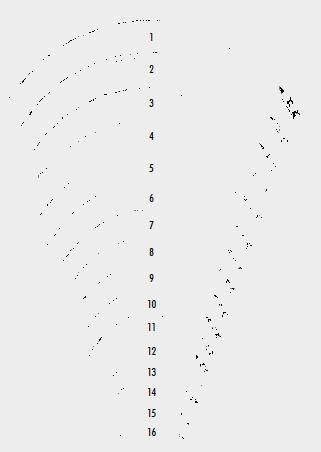 Голки хірургічні, з пружинним вушком діаметром 1,1 мм (mm), ріжучі зворотні (ріжуча), окружність 3/8, довжиною 50,0 мм (mm)